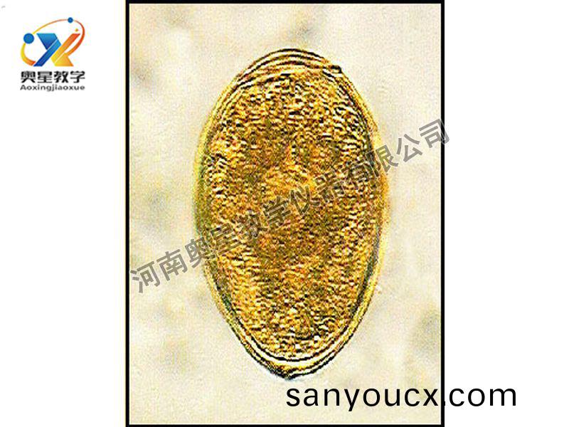 斯氏(shi)竝殖吸蟲卵原(yuan)圖