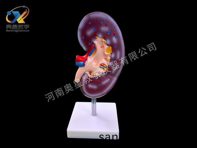 腎解剖糢(mo)型
